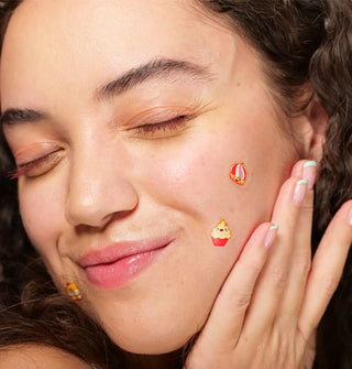 Model wears three Brunch Date Pimple Patches on cheeks